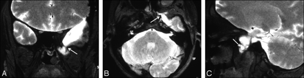 Fig 4.