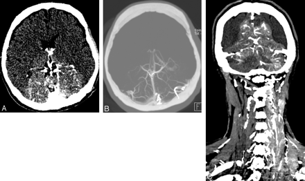 Fig 1.