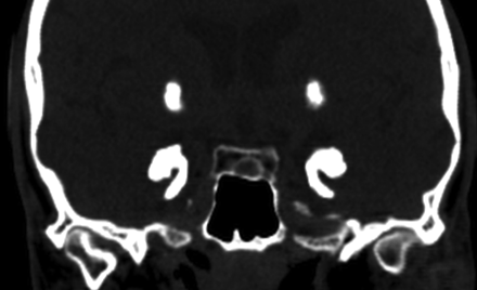 Fig 2.