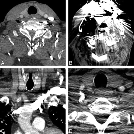Fig 2.