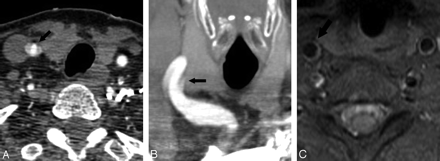 Fig 4.