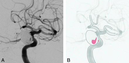 Fig 6.