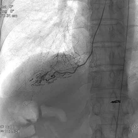 Fig 1.