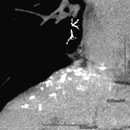 Fig 2.