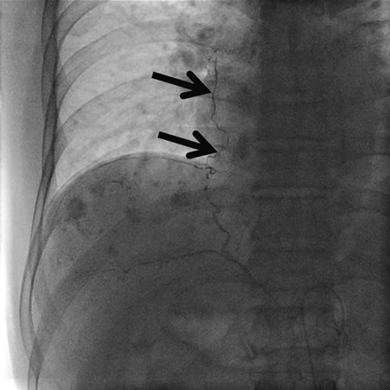 Fig 3.