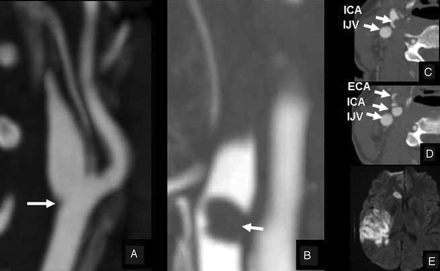 Fig 1.