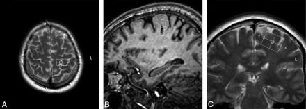 Fig 1.