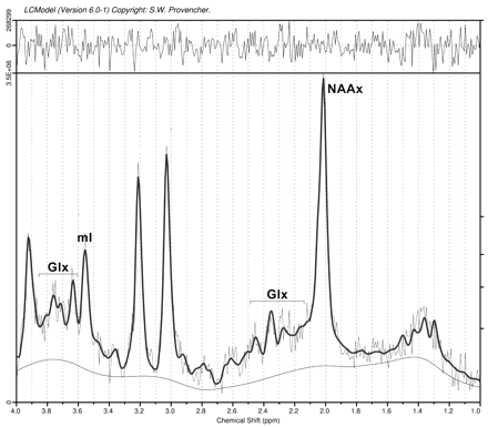 Fig 3.