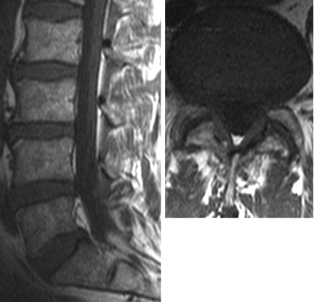 Fig 2.