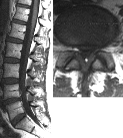 Fig 3.