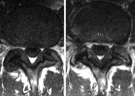 Fig 5.