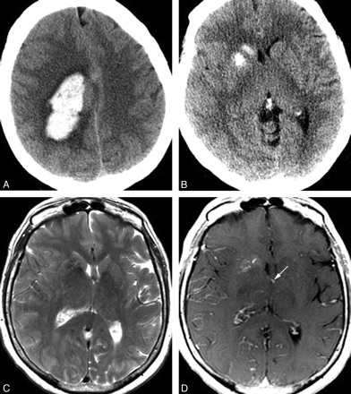 Fig 1.