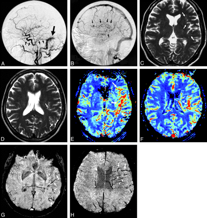 Fig 1.