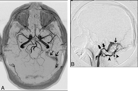 Fig 12.