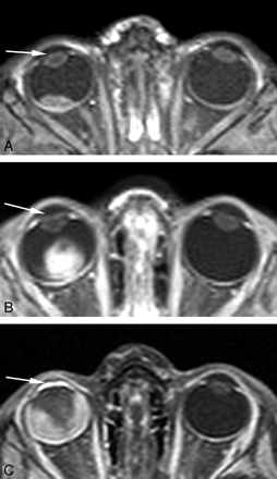 Fig 1.