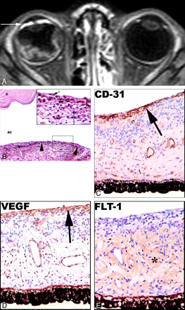 Fig 3.