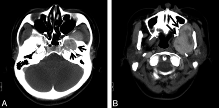 Fig 1.