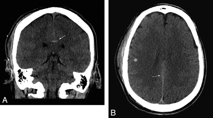 Fig 3.