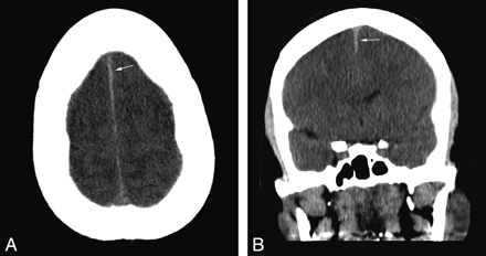 Fig 4.