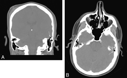 Fig 6.