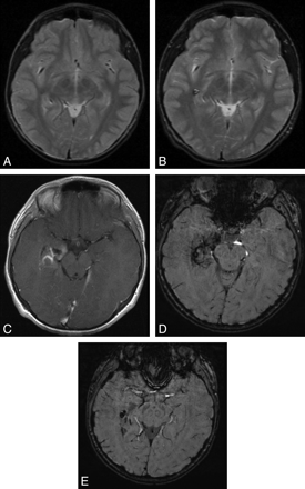Fig 2.