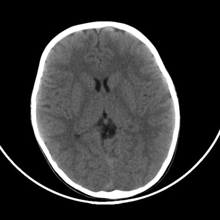 Fig 1.