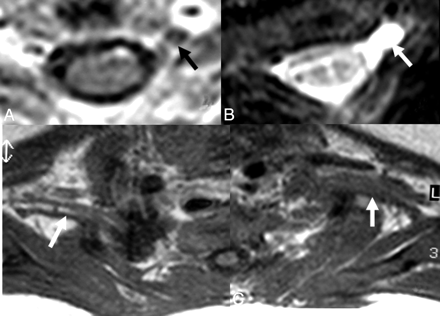 Fig 2.