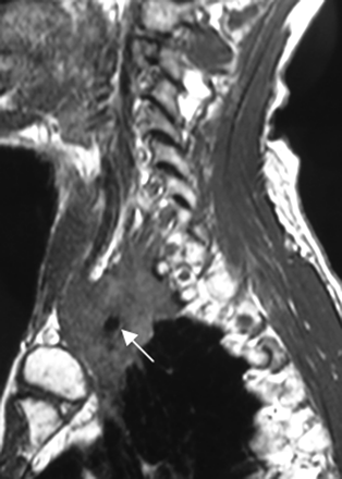 Fig 6.
