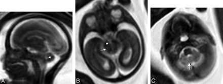 Fig 1.