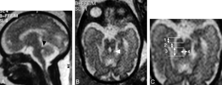 Fig 3.