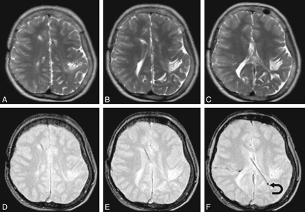 Fig 2.