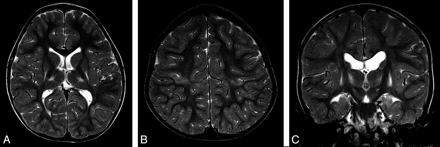 Fig 3.
