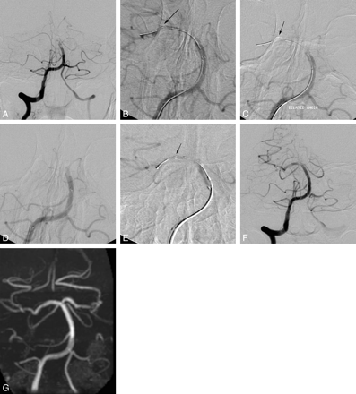 Fig 2.