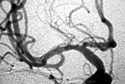 Fig 2.