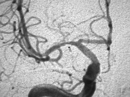 Fig 3.