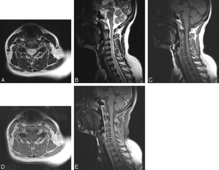 Fig 2.