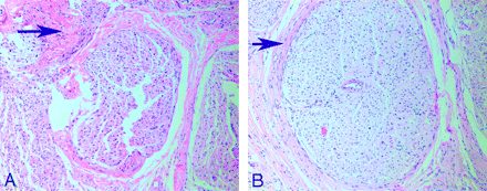 Fig 4.