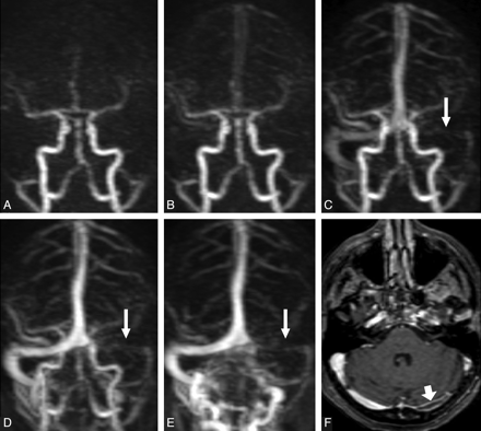 Fig 1.