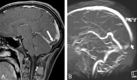 Fig 2.