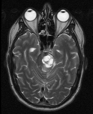 Fig 2.
