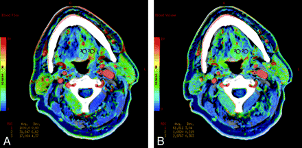 Fig 3.