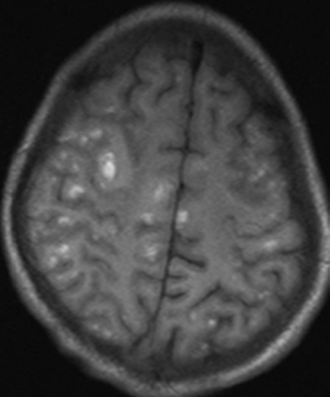 Fig 1.