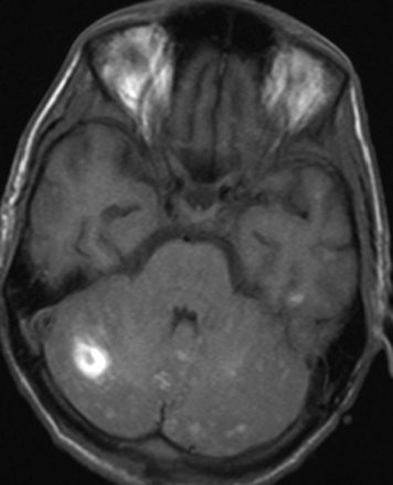 Fig 2.