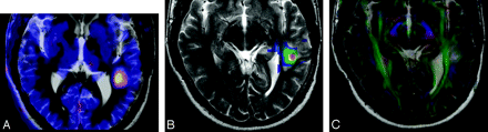 Fig 1.