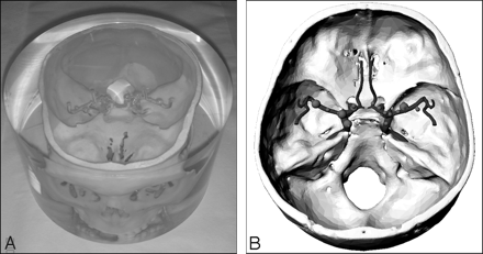 Fig 1.