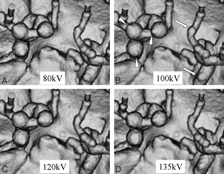 Fig 4.