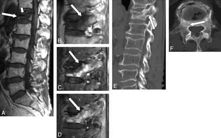Fig 2.