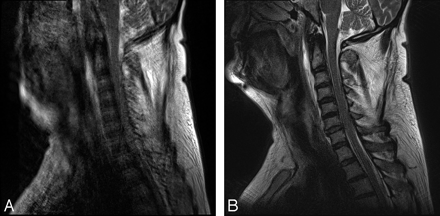 Fig 5.