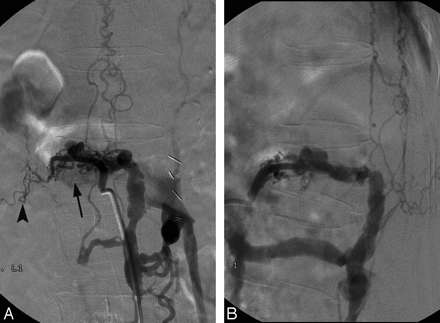 Fig 3.
