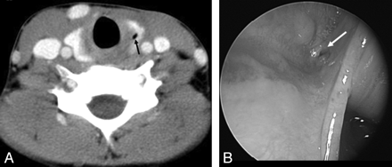 Fig 3.